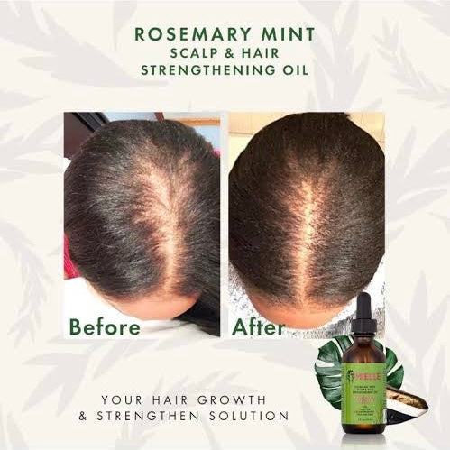 MIELLE
Rosemary Mint Scalp & Hair Strengthening Oil