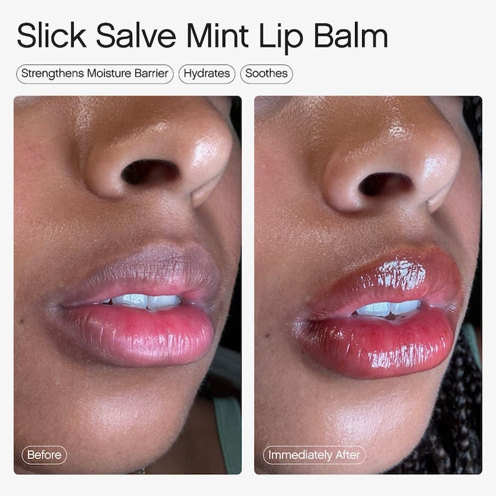 Topicals 
Slick Salve Glossy Lip Balm for Soothing + Hydration Mint